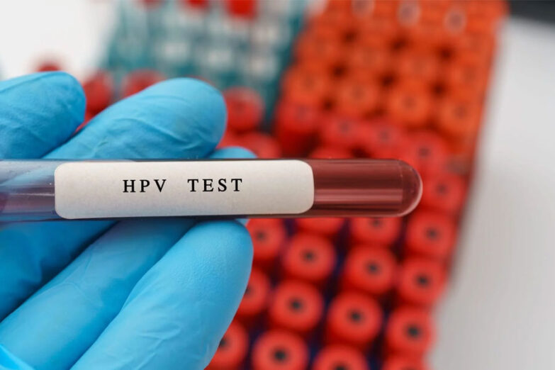 أآزمایش HPV