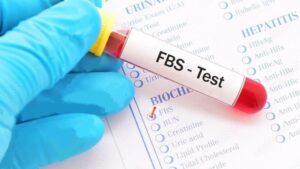 fbs test